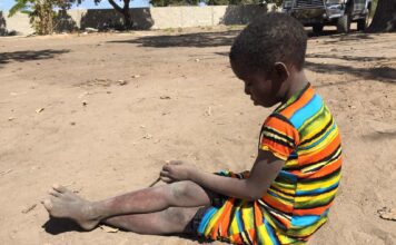 JE NE PEUX PAS ME SAISIR DES LARMES AUX YEUX