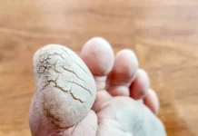 C’EST GRAVE: TO SEKA MUKIE EROSION YA MAKOLO KIEKIEKIEKIE