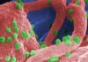 “Hopes for HIV Cure Rise with Gene-Editing Breakthrough”