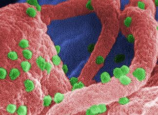 “Hopes for HIV Cure Rise with Gene-Editing Breakthrough”