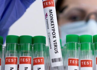 “Emerging Threat: DR Congo Faces Most Dangerous mpox Strain Yet”