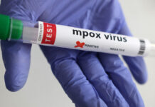 “Africa’s Health Agency: Mpox Vaccinations Could Begin Within Days” CNTLIVE