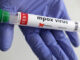 “Africa’s Health Agency: Mpox Vaccinations Could Begin Within Days” CNTLIVE