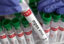 UK Detects Cluster of New Mpox Variant Linked to Africa