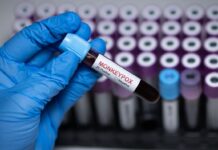 Morocco Leads with Africa’s First Locally Manufactured Mpox Tests