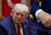 Des préoccupations concernant la santé de Donald Trump font de nouveau la une des médias.