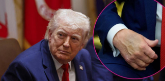 Des préoccupations concernant la santé de Donald Trump font de nouveau la une des médias.