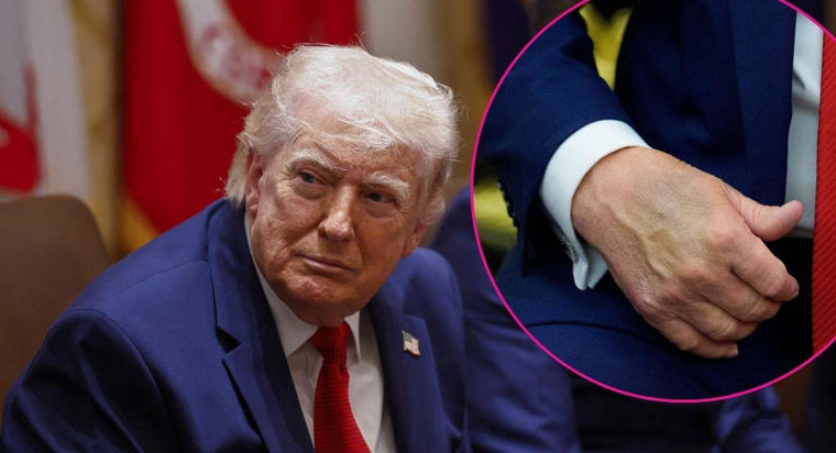 Des préoccupations concernant la santé de Donald Trump font de nouveau la une des médias.